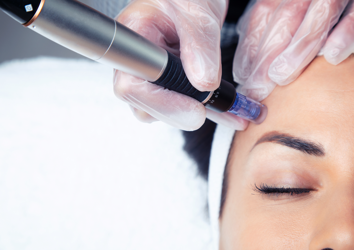 Kosmetikerin führt eine professionelle Micro-Needling-Behandlung im Gesicht einer Kundin durch.