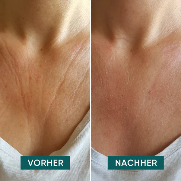APRICOT Dekolleté Pad mit Hyaluron für intensive Feuchtigkeit und Pflege des Dekolletés