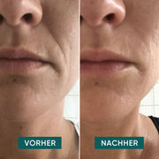 APRICOT Mund Pads mit Hyaluron für die Pflege der Lippen- und Mundpartie