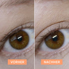 APRICOT Schlupflid Tapes für eine optisch geöffnete Augenpartie und einen wachen Blick