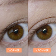 APRICOT Schlupflid Tapes für eine optisch geöffnete Augenpartie und einen wachen Blick