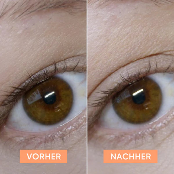 APRICOT Schlupflid Tapes für eine optisch geöffnete Augenpartie und einen wachen Blick