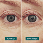 APRICOT Augen Pads mit Hyaluron für die Pflege und Feuchtigkeitsversorgung der Augenpartie