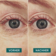 APRICOT Augen Pads mit Hyaluron für die Pflege und Feuchtigkeitsversorgung der Augenpartie