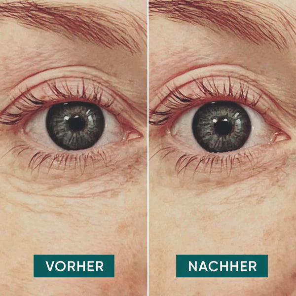 APRICOT Augen Pads mit Hyaluron für die Pflege und Feuchtigkeitsversorgung der Augenpartie